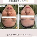 四天王寺エリア◎くすみ・たるみ・乾燥がお悩みの方必見！